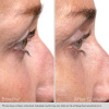 Сыворотка для роста ресниц Nu-Cil / Nu-Cil Eyelash Enhancing Serum Obagi