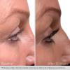 Сыворотка для роста ресниц Nu-Cil / Nu-Cil Eyelash Enhancing Serum Obagi